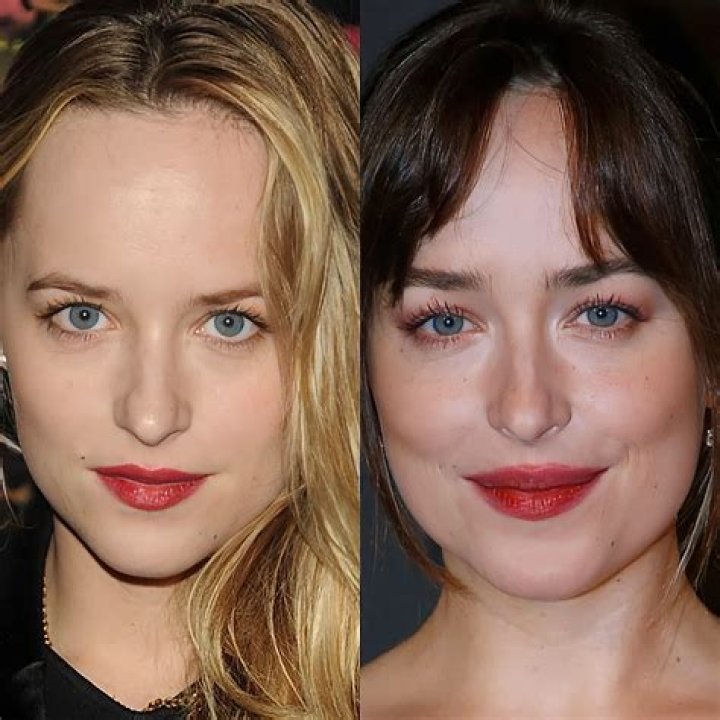 Ali Lohan’s Nose Job