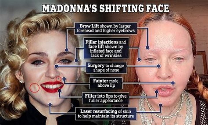bitchy | madonna puffy face