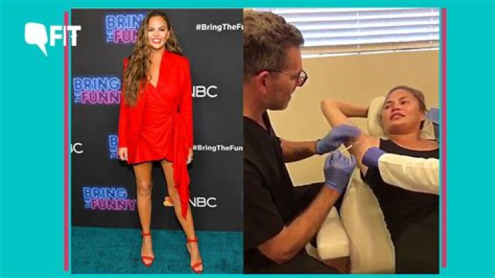 Chrissy Teigen shares video getting Botox in her armpits to prevent sweating