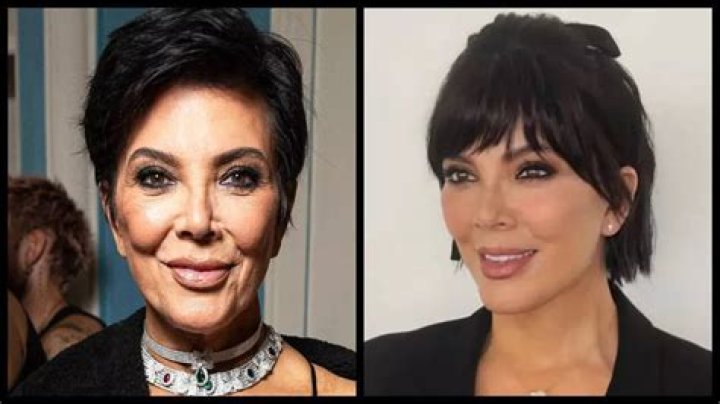 Did Kourtney Kardashian go to Kim’s plastic surgeon?