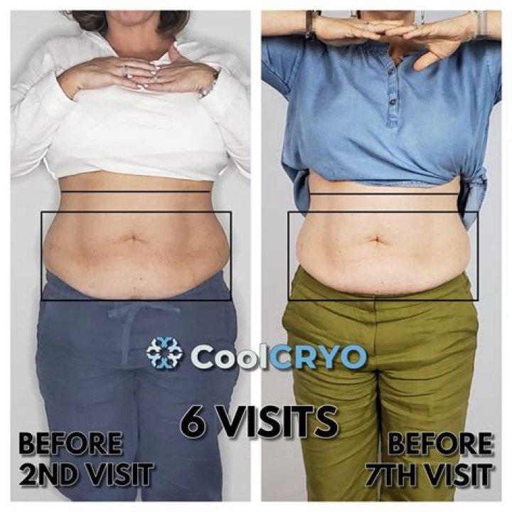 Drew Barrymore endorses 4k stomach sculpting procedure: ‘I was never losing weight’