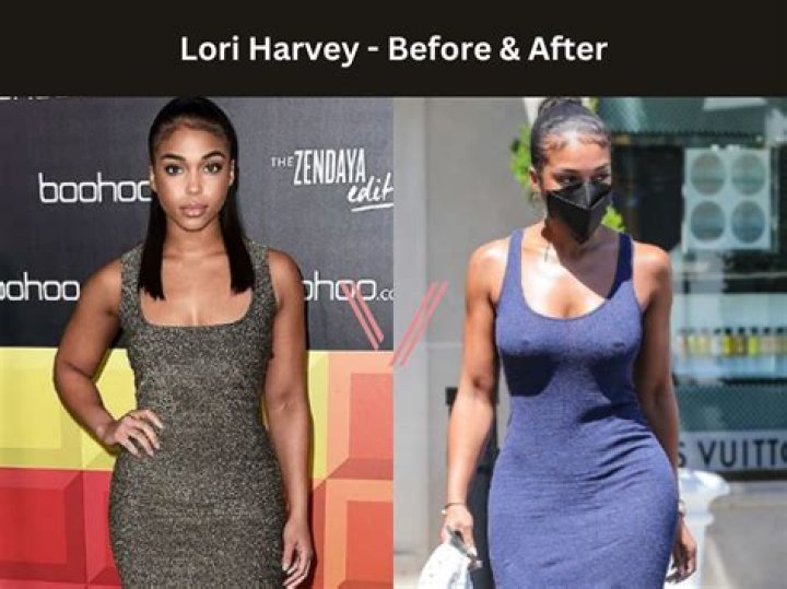 Lori Harvey Plastic Surgery: Has She Got BBL? No Makeup Looks