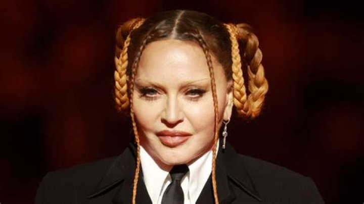 Madonna: ‘Look how cute i am now that swelling from surgery has gone down. Lol’