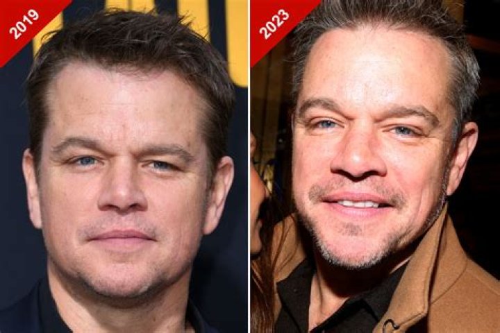 Matt Damon, plastic surgery victims come out to ‘His Way’ premiere