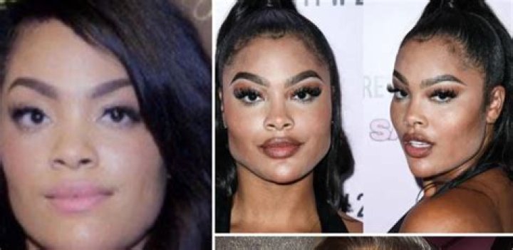 Mehgan James Plastic Surgery Nose Job And Botox Before And After