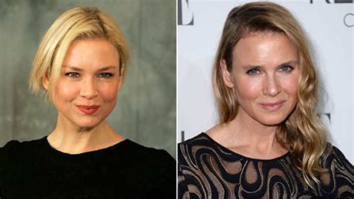 Renee Zellweger looks much different, would you recognize her?