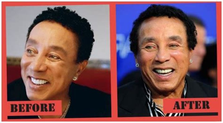 Smokey Robinson Facelift: Did He Get Surgery? Before And After Pics, Age And Height