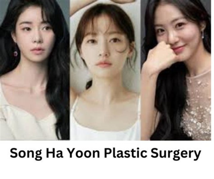 Song Ha-Yoon Plastic Surgery: Did Actress Undergone Any Beauty Procedure