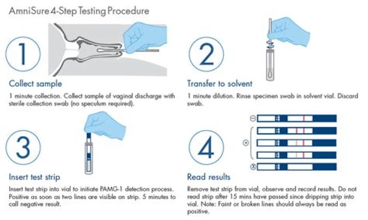 What does a positive AmniSure test mean?